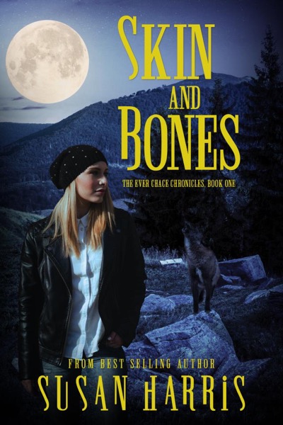 Skin and Bones by Susan Harris